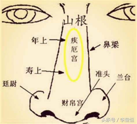 天刑 疾厄宮